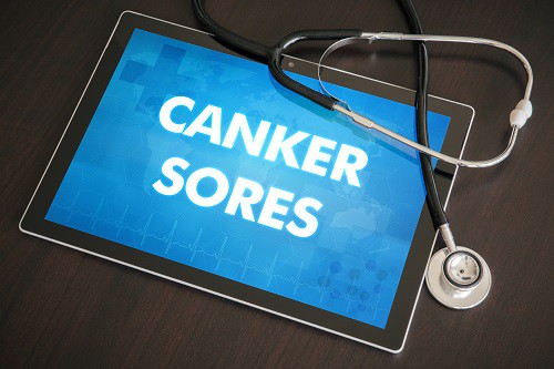 How to Get Rid of a Canker Sore
