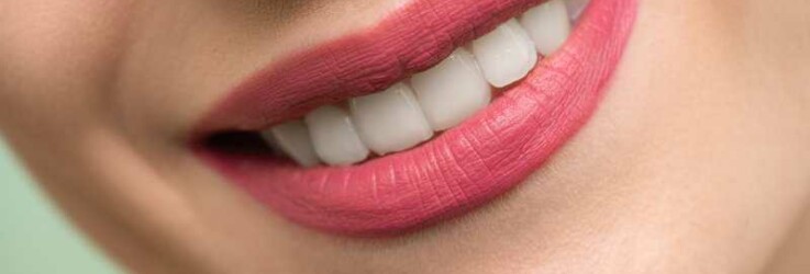 How Dental Veneers Can Make Your Teeth Look Better
