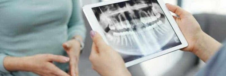 How Often Do I Need Dental X-Rays? 